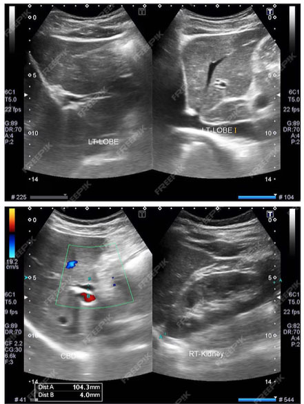 chololithiasi_diagnosi https://xeirourgosiatros.gr/wp-content/uploads/2024/04/chololithiasi_diagnosi.jpg